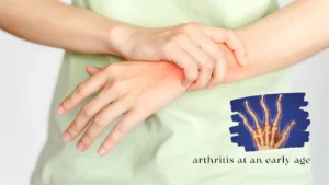 How to prevent arthritis at an early age